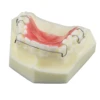 Dental Orthodontic Typodont Teeth Model With Self-Ligating Metal Ceramic Bracket Lingual Hawley Retainer Ligature Standard Demo 5