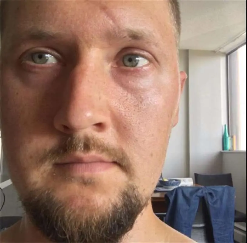 BLACK FRIDAY SALE Temporary Firming Eye Cream Ceelic