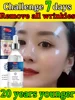 wrinkles disappear become beautiful now 1