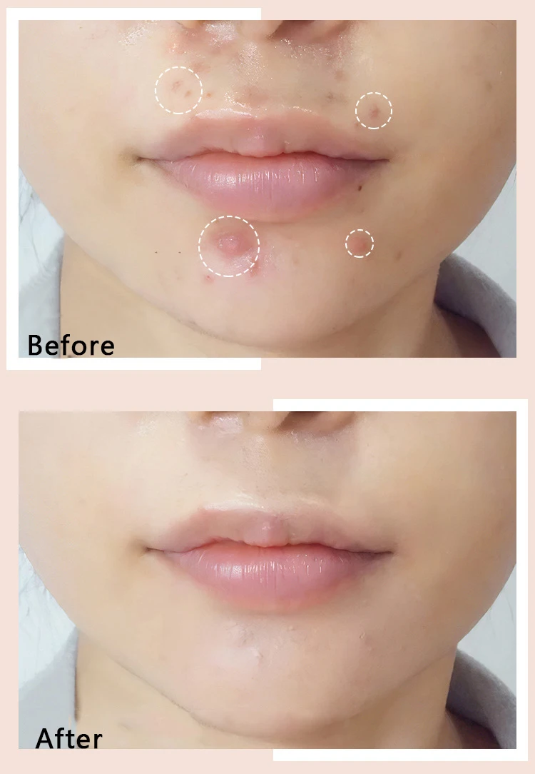 HAOZHUANG Concealer Under the Eyes Bases Face Brand Makeup Correctors Dark Circles Concealer Pen Waterproof Makeup Base 2024 5