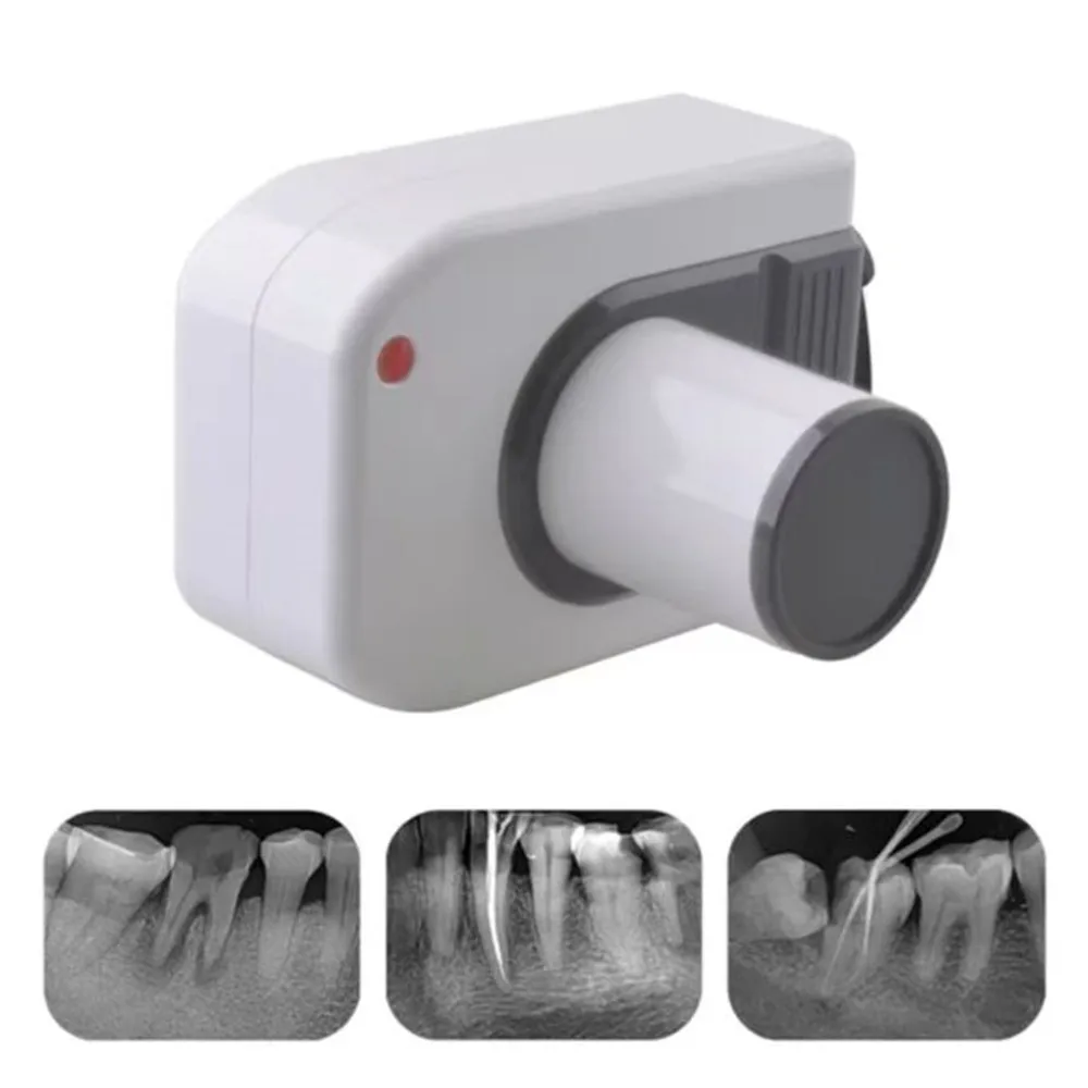 

Dental Portable X Ray Machine X-Ray Unit Radiation Free High Frequency Dental Imaging System Dentist Machine