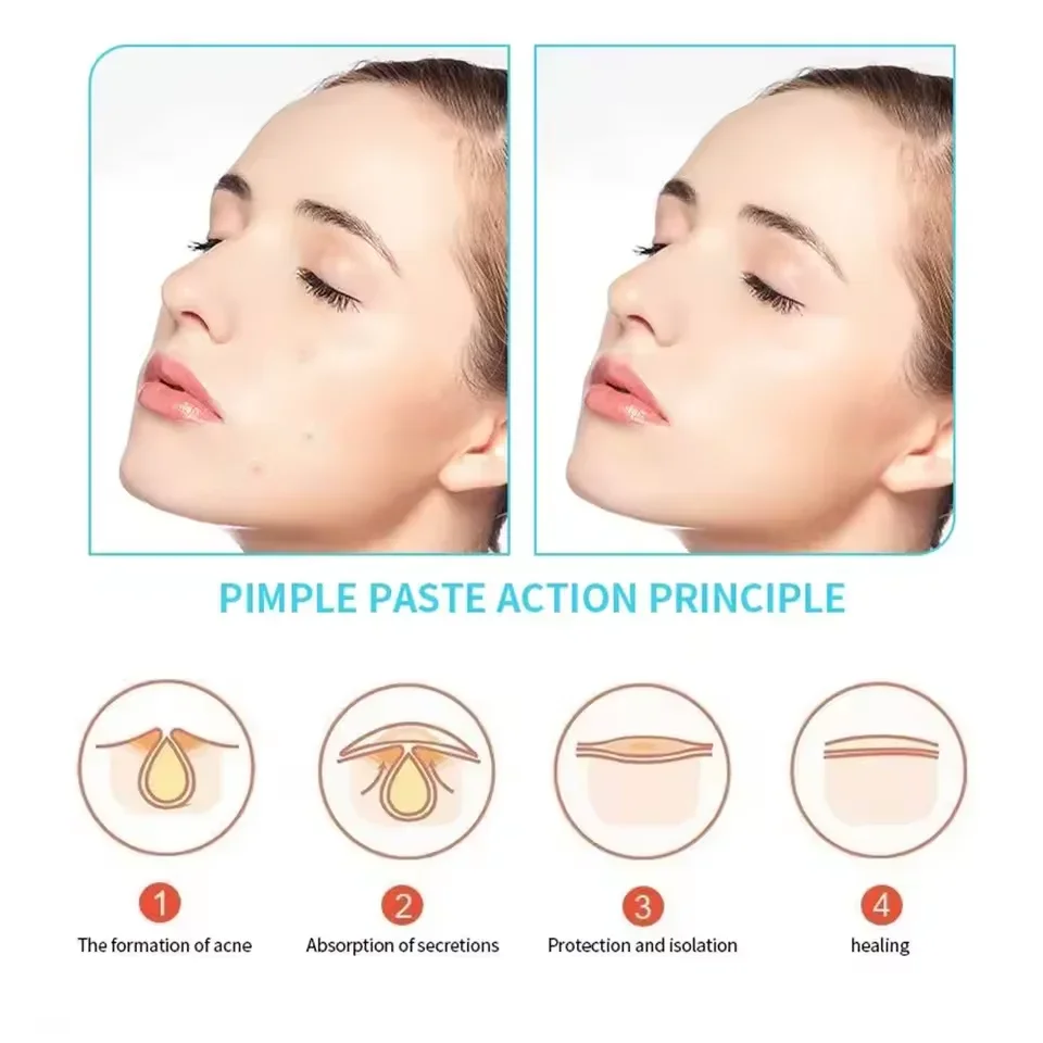 1260Pcs Invisible Acne Patches Removal Pimple Anti-Acne Hydrocolloid Patches Spots Marks Concealer Repair Sticker Waterproof