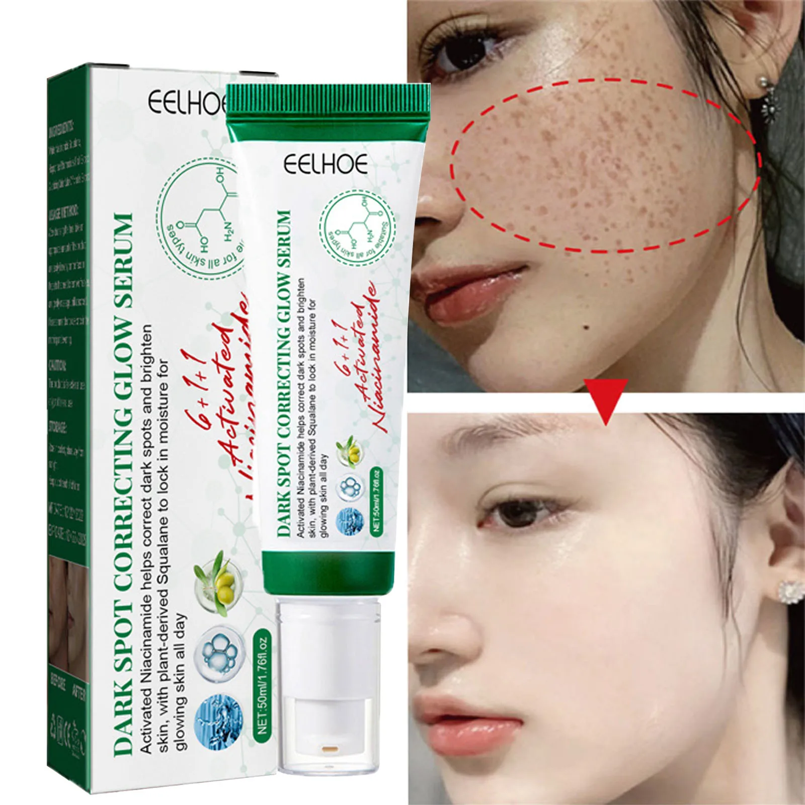 Whitening Freckle Removal Face Cream Remove Melasma Dark Spots Lighten Melanin Brighten Anti-Aging Moisturizing Korean Skin Care