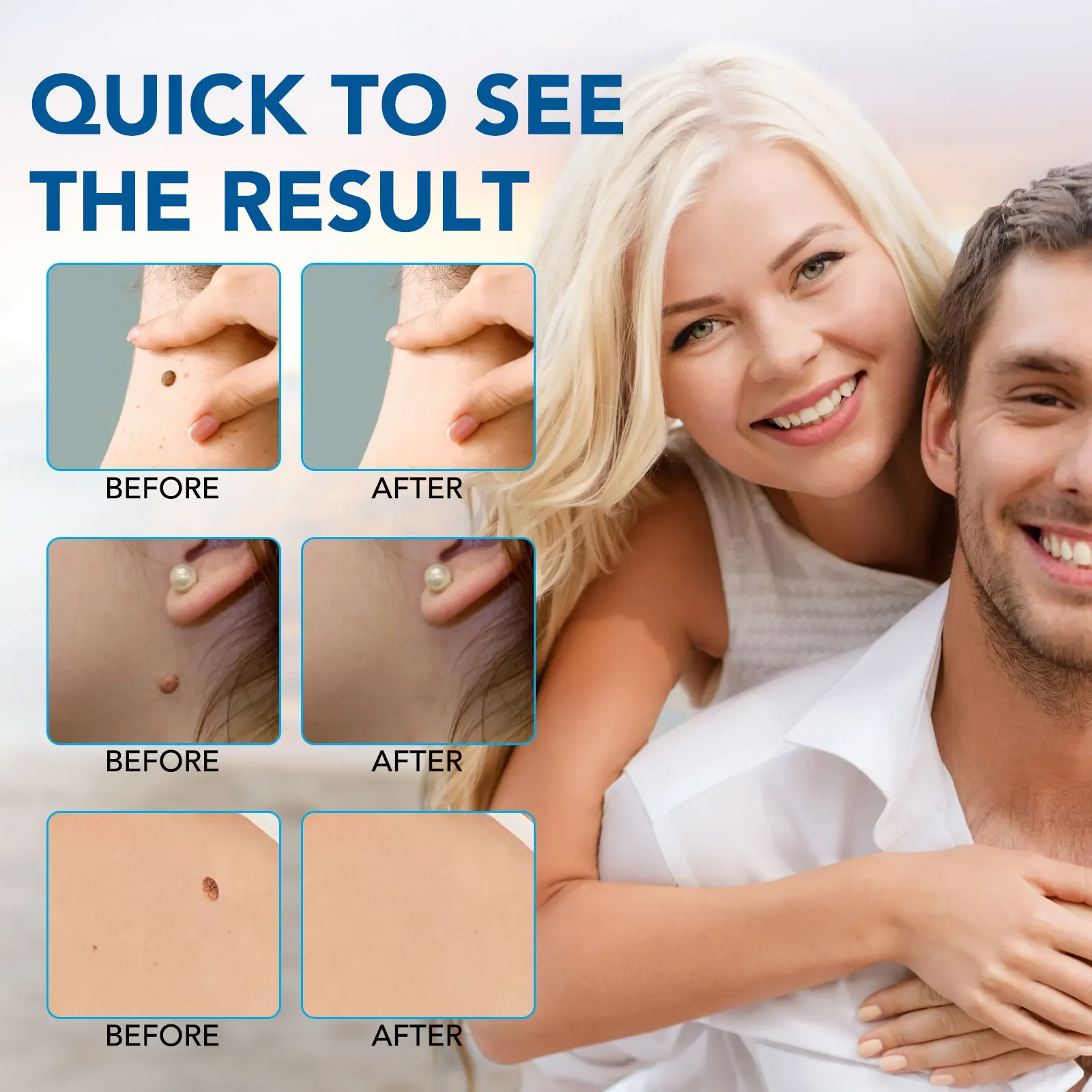 Skin Tag Removal Pen Home Use Painless Safe Skin Tag Mole Wart Spot Removal Equipment for Smooth Skin