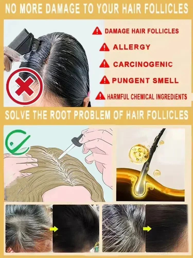 Hair Coloring Product Remove Gray Hair and Restore Natural Color in 7 Days