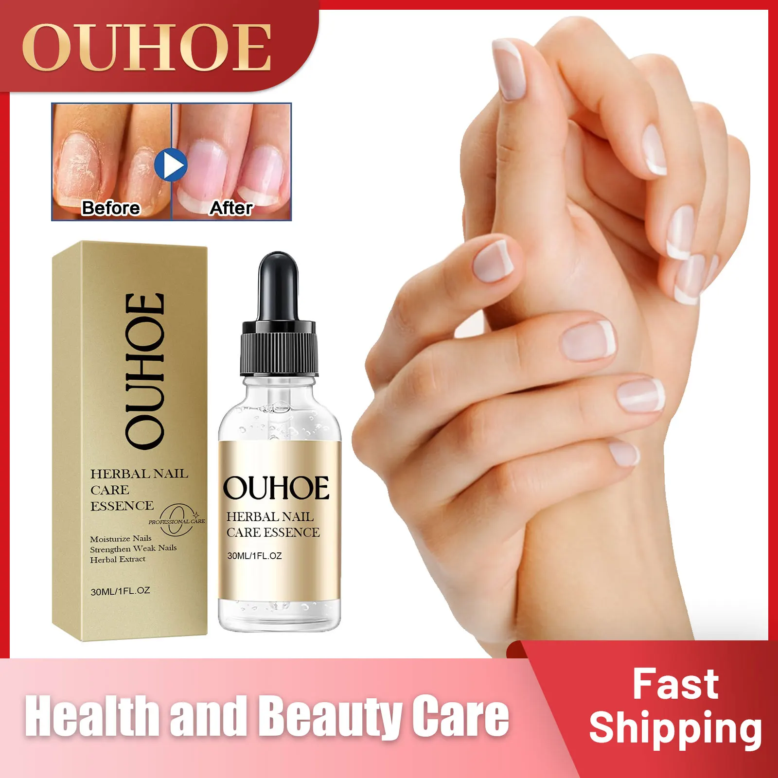 

Herbal Nail Essence Fungal Repair Remove Infection Whitening Hand Foot Toenail Treatment Moisturizing Nourish Nail Care Liquid