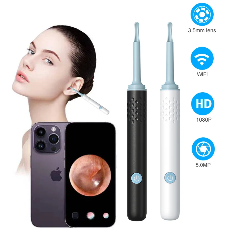 Smart Visual Ear Wax Removal 1