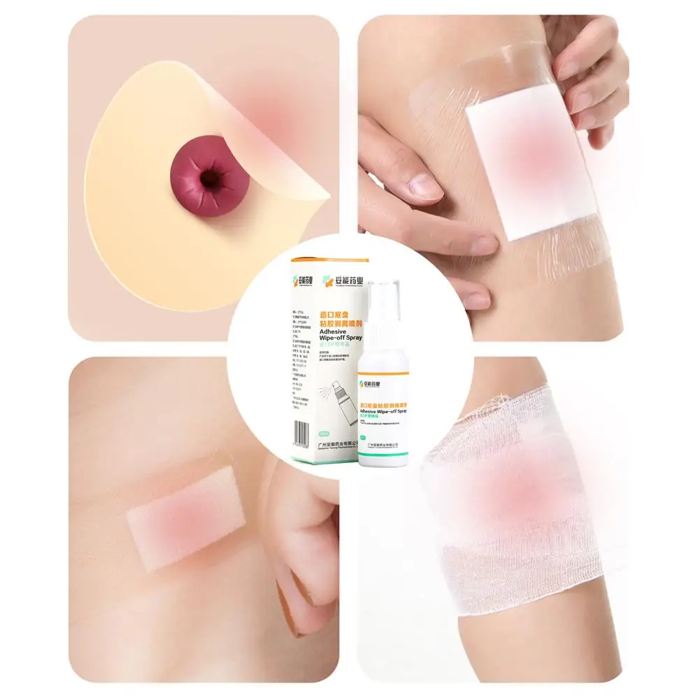 Colostomy Adhesive Remover 30ML Wipe-Off Spray Medical Ostomy Bag Care
