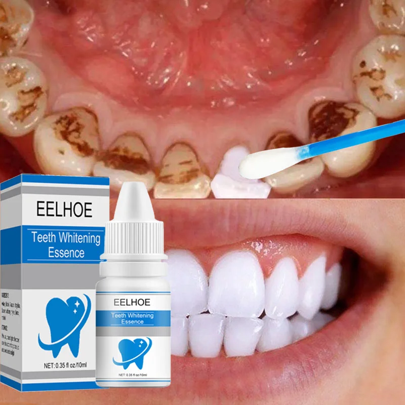 

Teeth Whitening Essence Remove Plaque Stains Fresh Breath Oral Hygiene Against Dental Caries Serum Dental Tooth Cleaning Tools