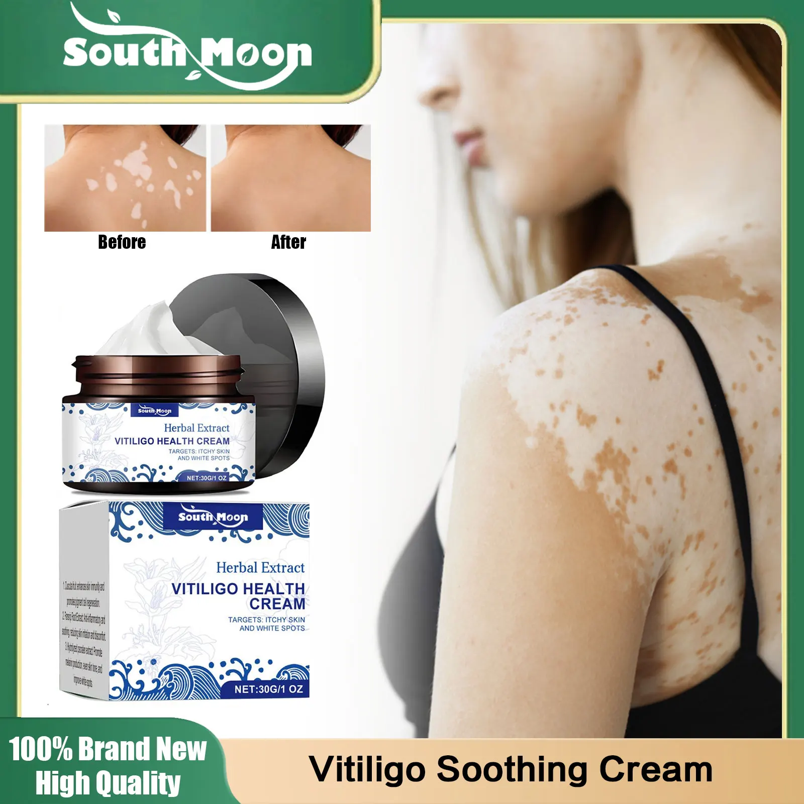 Vitiligo Ointment Remove Mycosis Ringworm White Spot Melanin Growth Antibacterial Improve Leukoplakia Disease Eliminate Vitiligo