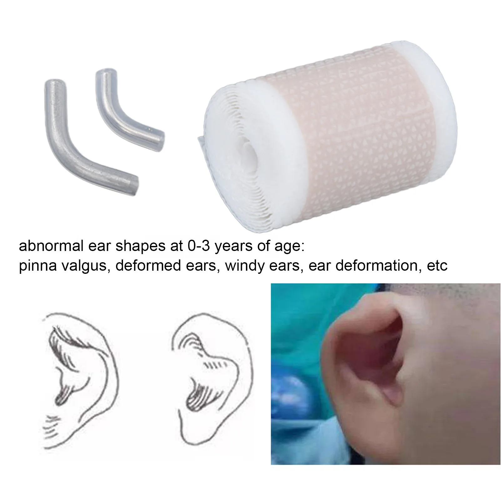

Корректор ушей для малышей, силиконовая корректирующая Накладка для ушей, удобная для кожи, гелевая лента для ушей для младенцев, наклейка для ушей I