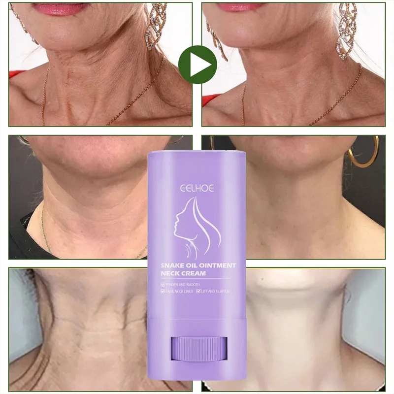 Neck Cream Moisturis Lift Neck Eliminate Double Chin Eliminate Fine Lines Anti-ageing Brightening Moisturizer