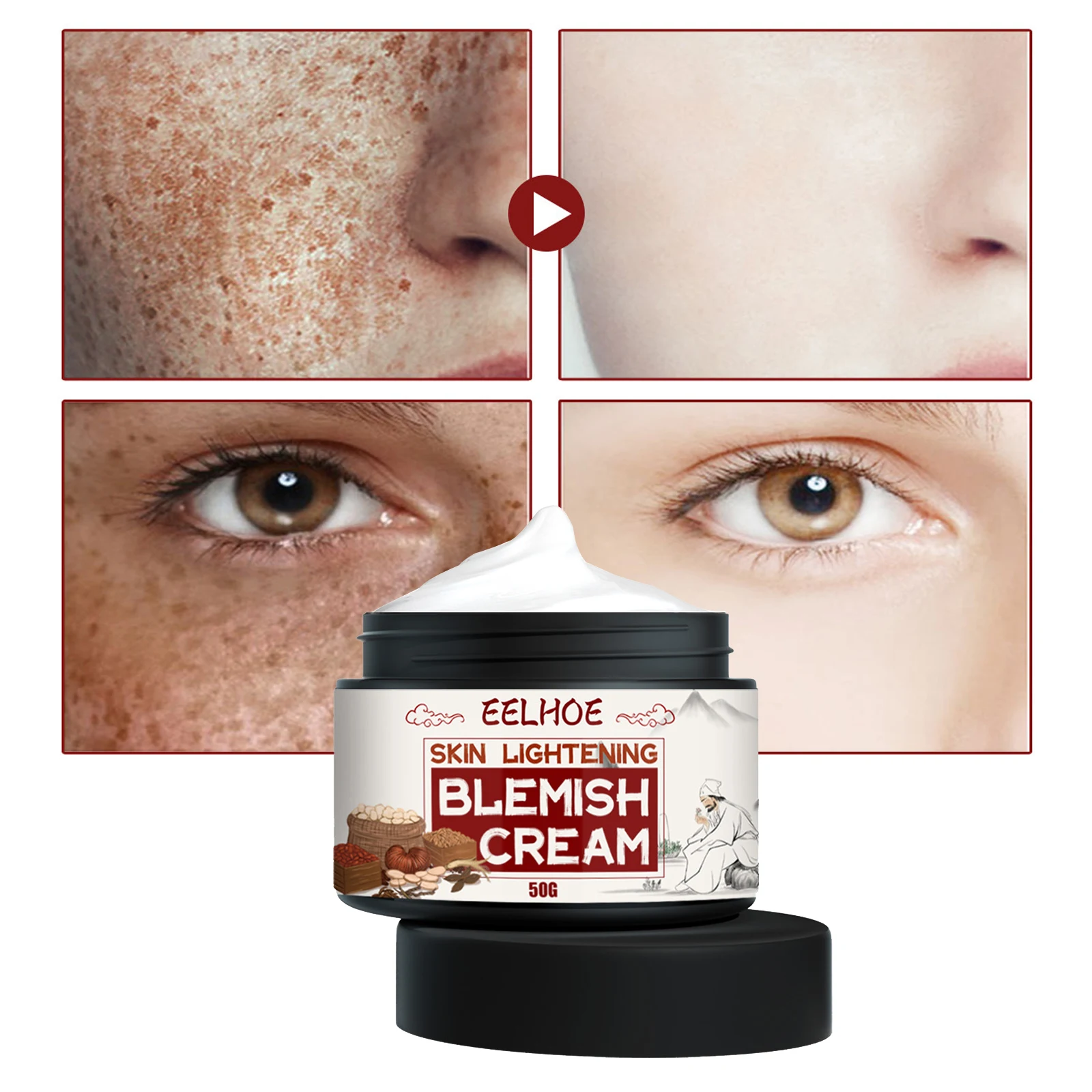 

Freckle Whitening Cream Remove Dark Spots Anti Brown Stain Lighten Pigmentation Moisturizing Whitener Skin Care Women