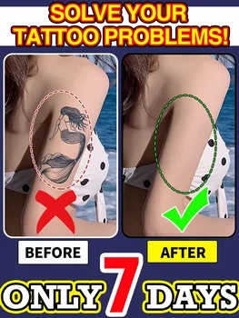 Olio essenziale per la rimozione dei tatuaggi, adatto per tatuaggi grandi e piccoli, rimuove efficacemente i tatuaggi permanenti