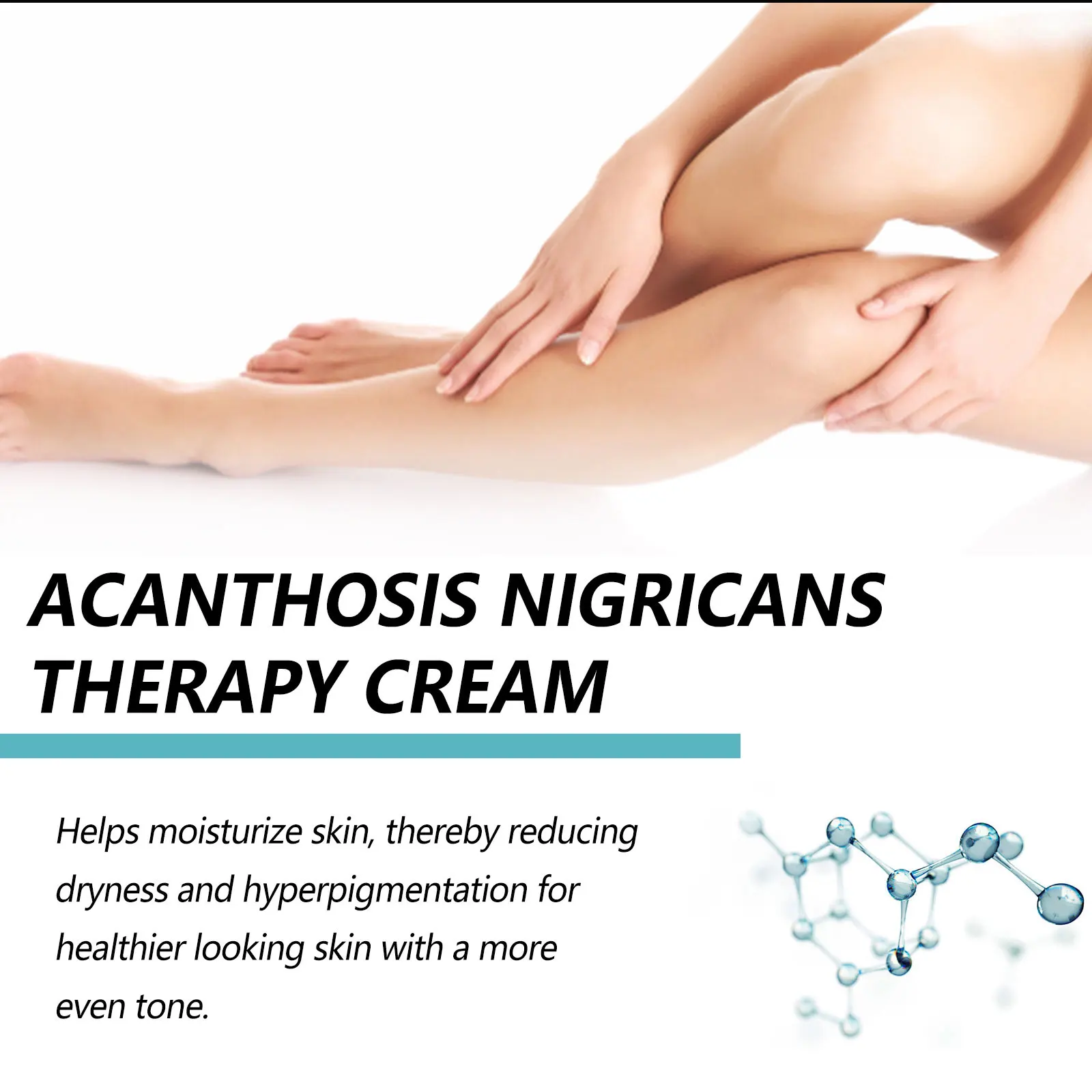 EELHOE Acanthosis Nigricans Therapy Cream Neck Arm Knee Joint Underarm Brightening Body Care Products Acantosis Nigricans Cream 4