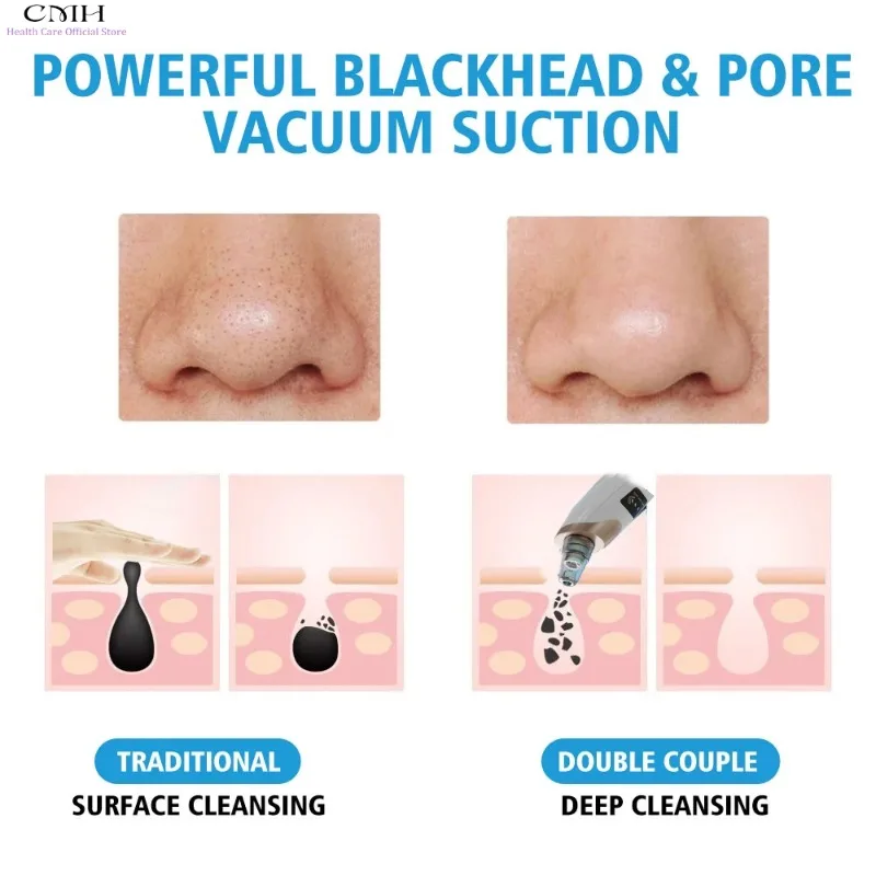 Blackhead remover vacuum with adjustable suction