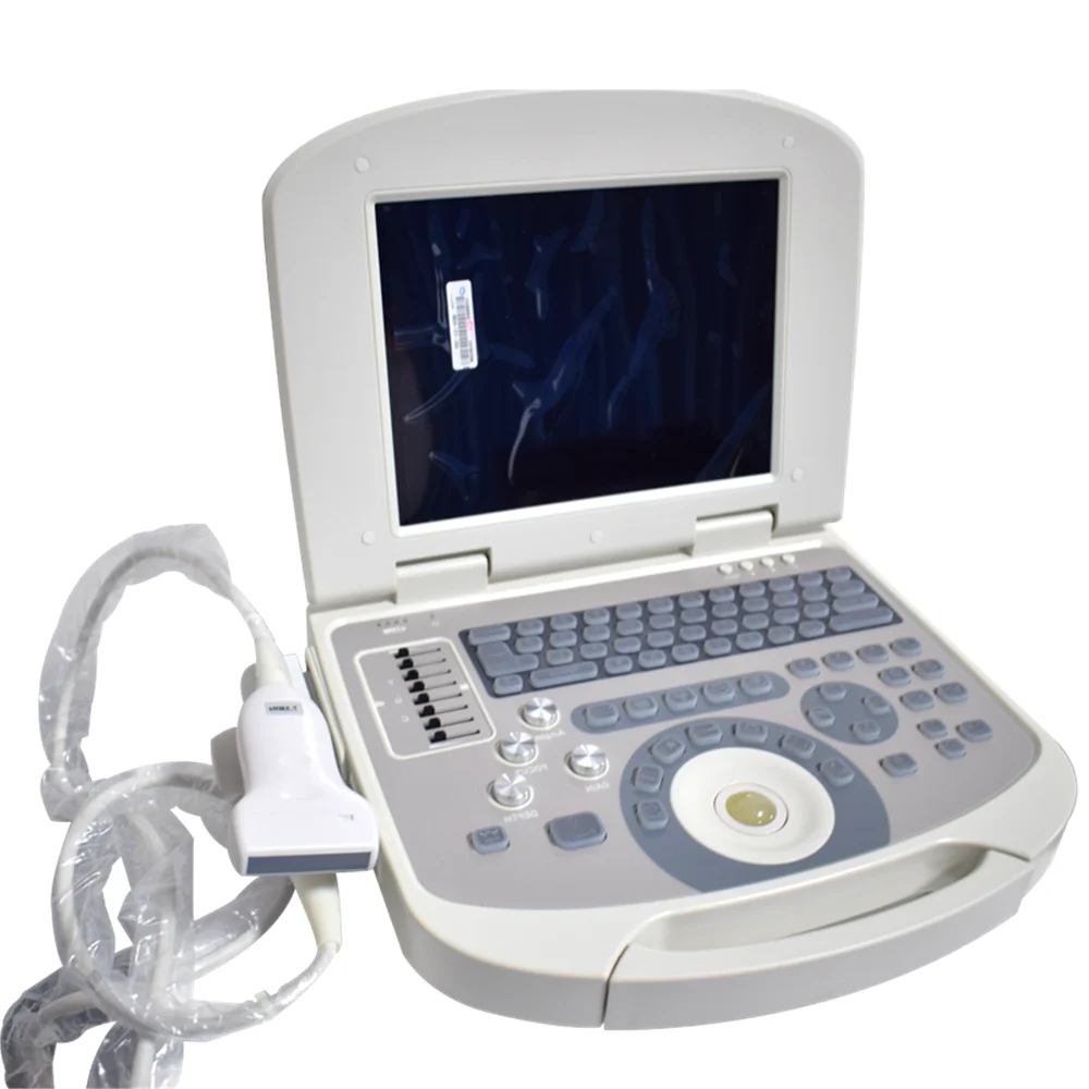 

laptop ultrasound machine and portable ultrasound