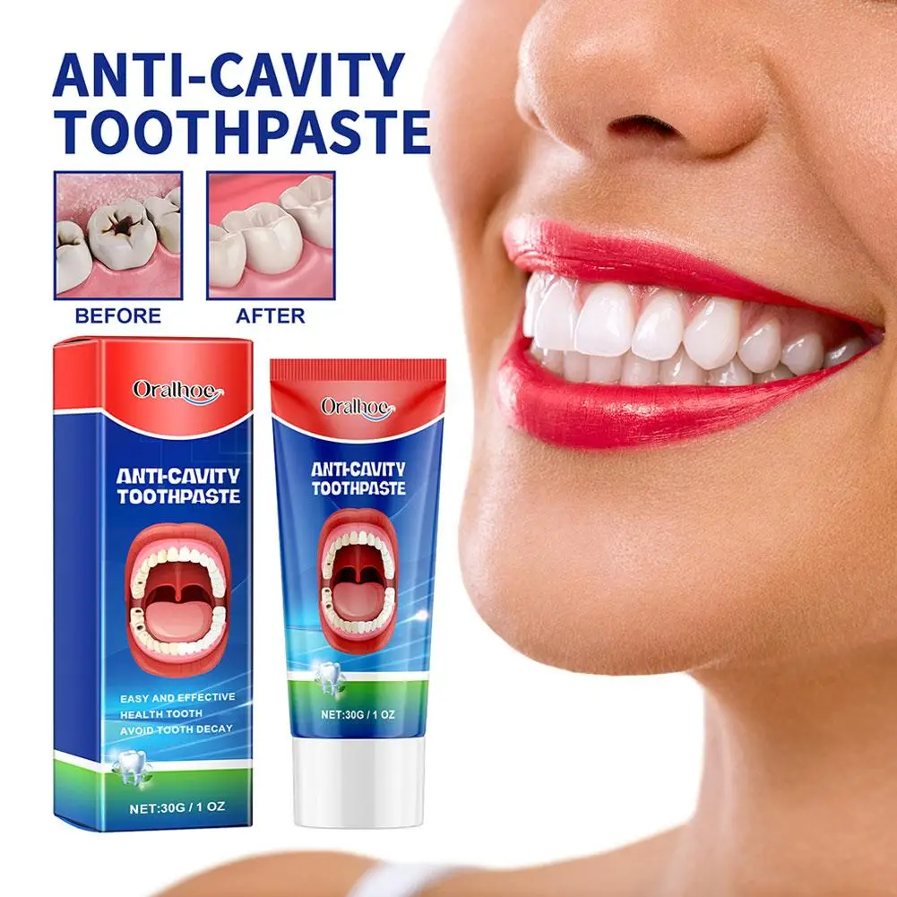 Anti Decay Toothpaste Dental Caries Repair Cream Prevent Tooth Decay Protect Teeth Remove Plaque Toothache Relieve Periodontitis teeth health product