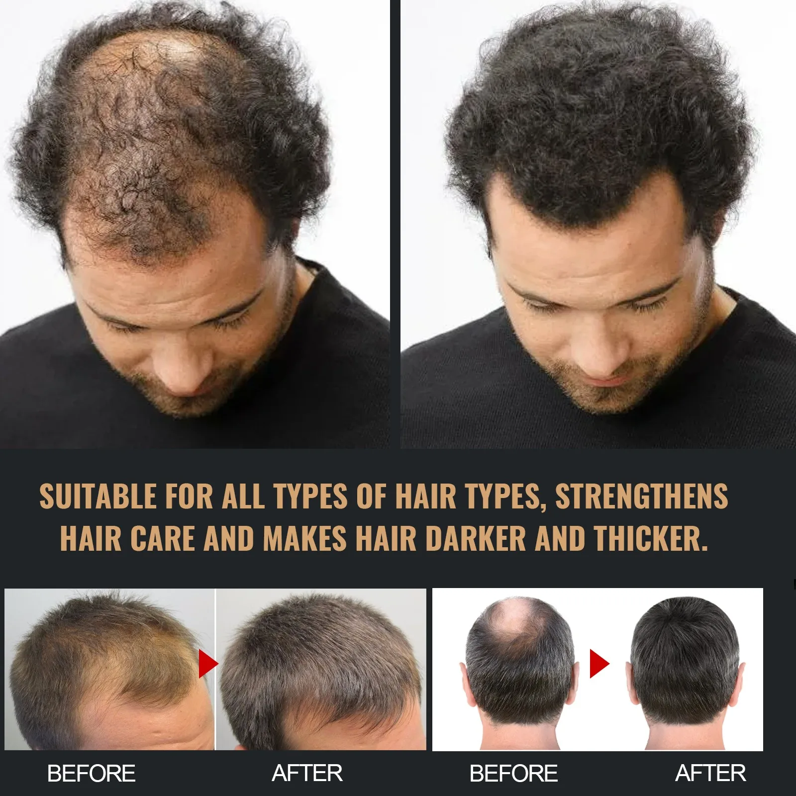 Shampoo Stimolante per la Radice dei Capelli Spartan per Uomo, Trattamento Delicato Nutriente e Volumizzante per la Ricrescita dei Capelli, Rinforza la Radice dei Capelli - immagine 2