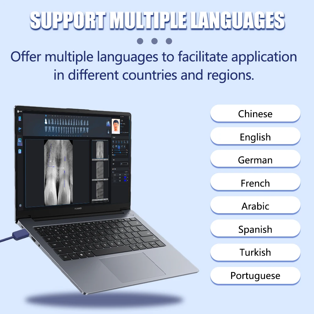EYY Sensore a raggi X dentale Trasmissione rapida Scanner intraorale Sistema di imaging HD Sensore a raggi X DynImage digitale con software gratuito - immagine 4