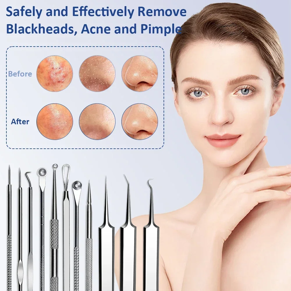 Professional Acne And Blackhead Removal Tool Kit For Face Care_voghion.com