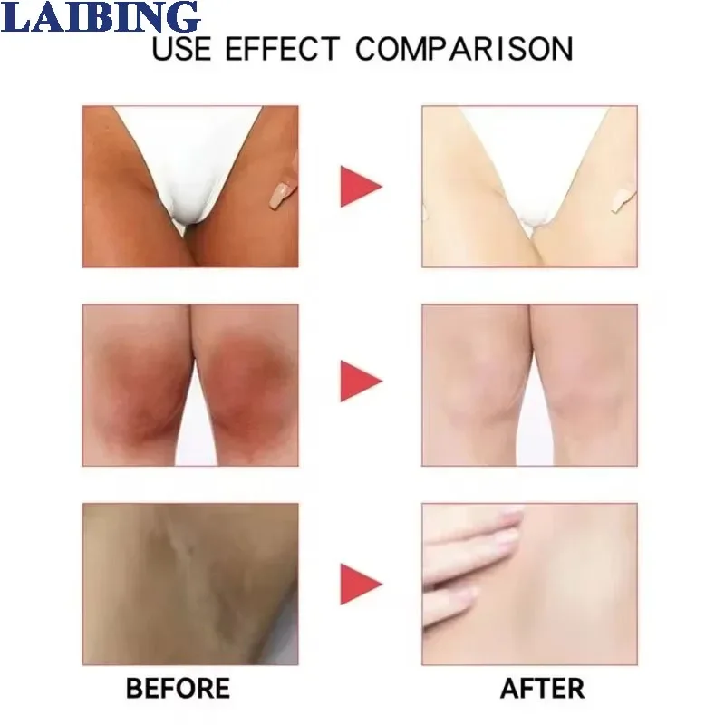 Niacinamide Intimate Area Brightening Cream Improves Dull Skin and Lightens Dark Pigmentation on Lips Underarms Thighs Knees 4