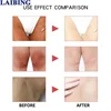 Niacinamide Intimate Area Brightening Cream Improves Dull Skin and Lightens Dark Pigmentation on Lips Underarms Thighs Knees 4