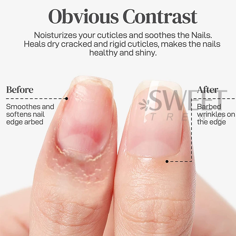 25ml Flower Nail Nutrition Oil Colorful Petals Nail Treatment Cuticle Revitalizer Oil Prevent Agnail Polish Nourish Skin nail care oil