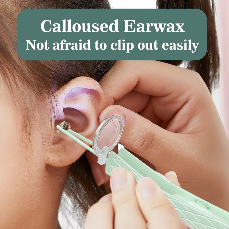 Ear Cleaner Spoon LED Flashlight Baby Earwax Curette Picker Visual  Endoscope Earpick Booger Wax Remover Tweezers Forceps Set - AliExpress