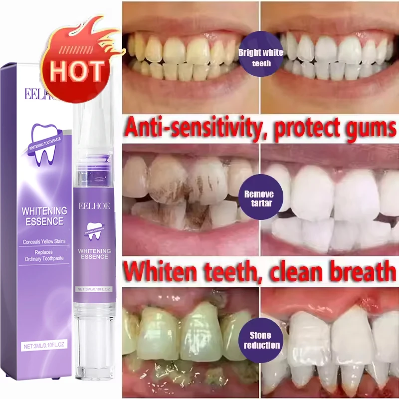 V34 Teeth Whtening Toothpaste Pen Remove Plaque Stains Cleaning Oral Hygiene Bleaching Dental Tools Fresh Breath Tooth Care teeth whitening product teeth whitening essence teeth health product