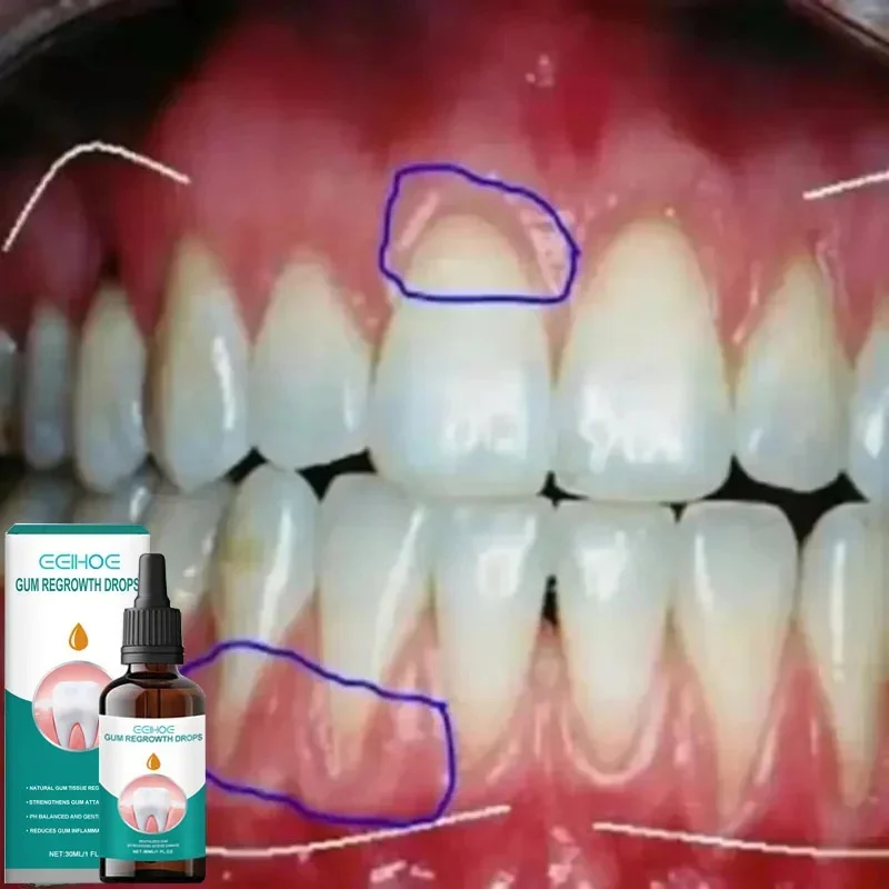 Rapid Repair Gums Serum Relieve Tooth Allergy Dental Caries Tooth Cleaning Toothpaste Relieve Damage Drops gum repair drops,teeth health product