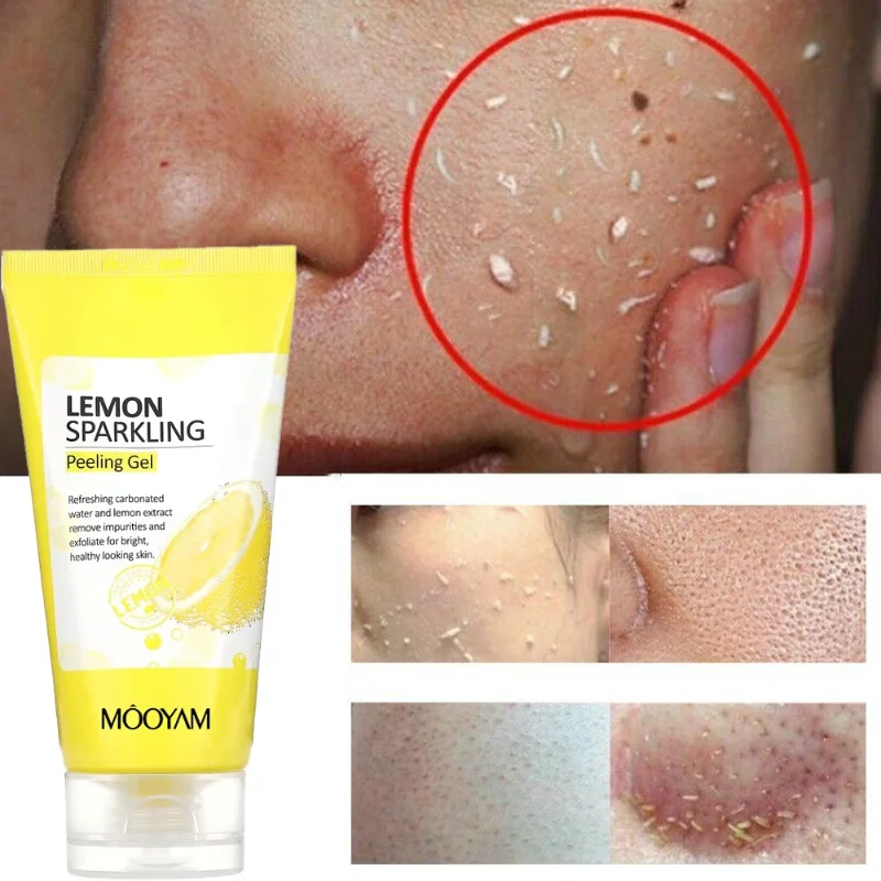 

Lemon Sparkling Peeling Gel Exfoliating Gel Scrubs Peeling Dead Skin Removal Gel For Face And Body Exfoliating