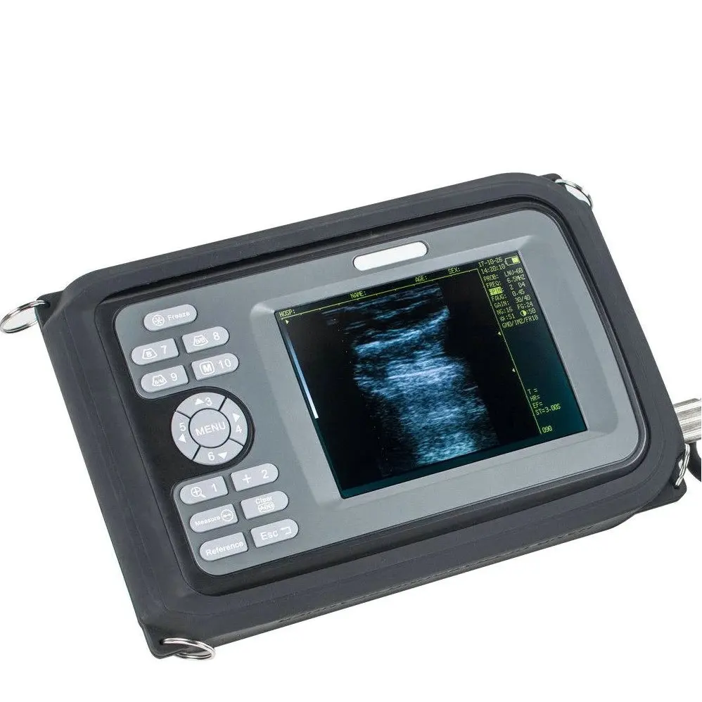 Рисунок 6 - FarmScan V8 Ветеринарный ультразвуковой