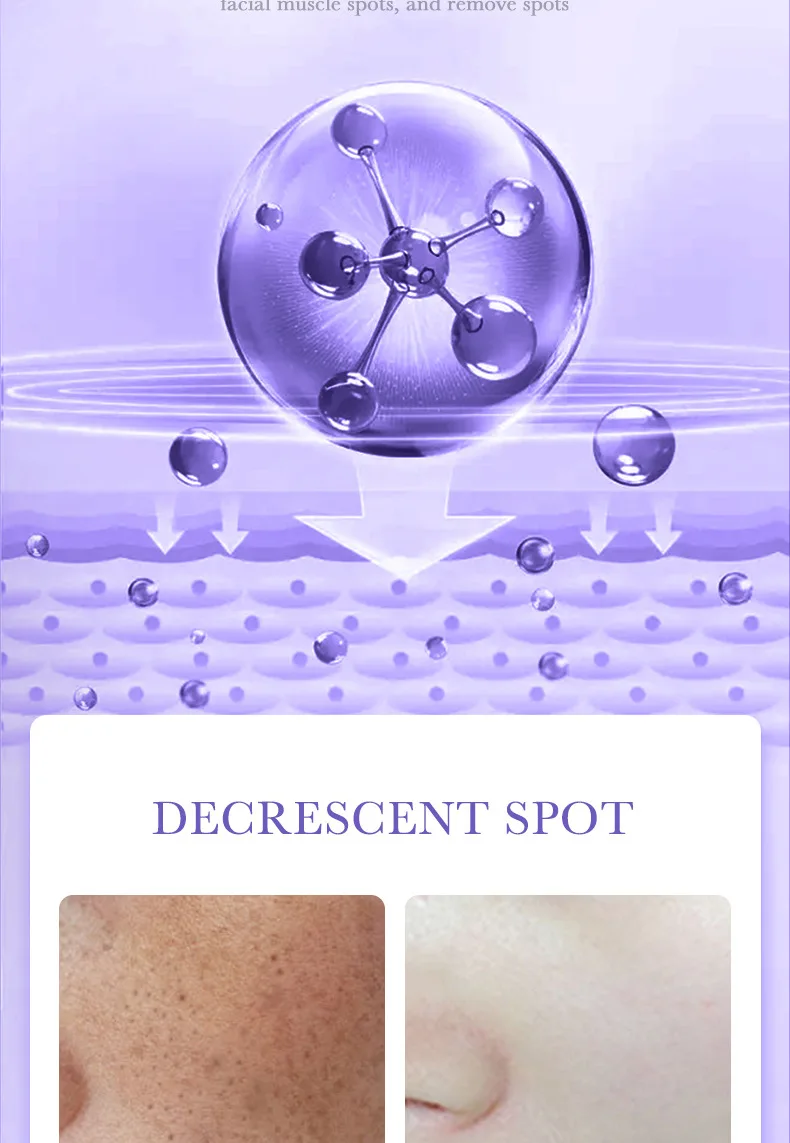 Niacinamide Whitening Freckle Mask Image 11