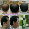 120ml Neo Hair Lotion Hair Root HAIR BEARD SIDEBURNS LONGER Herbs 100% Original Thailand Free Gift
