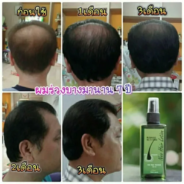 120ml Neo Hair Lotion Hair Root HAIR BEARD SIDEBURNS LONGER Herbs 100% Original Thailand Free Gift