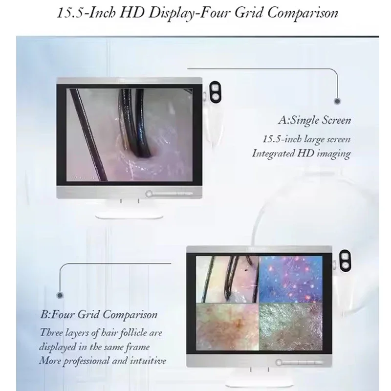 HD Digital Skin Analyzer Professional Hair Scalp Camera Detector Hair Follicle Oil Moisture Test Device 50/200X Lens 15inch