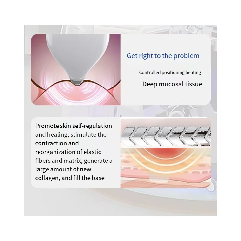 Pelvic Muscle Electrical Trainer Vaginal Trainer Kegel Exerciser Kegel Exerciser Women Improve Incontinence 6