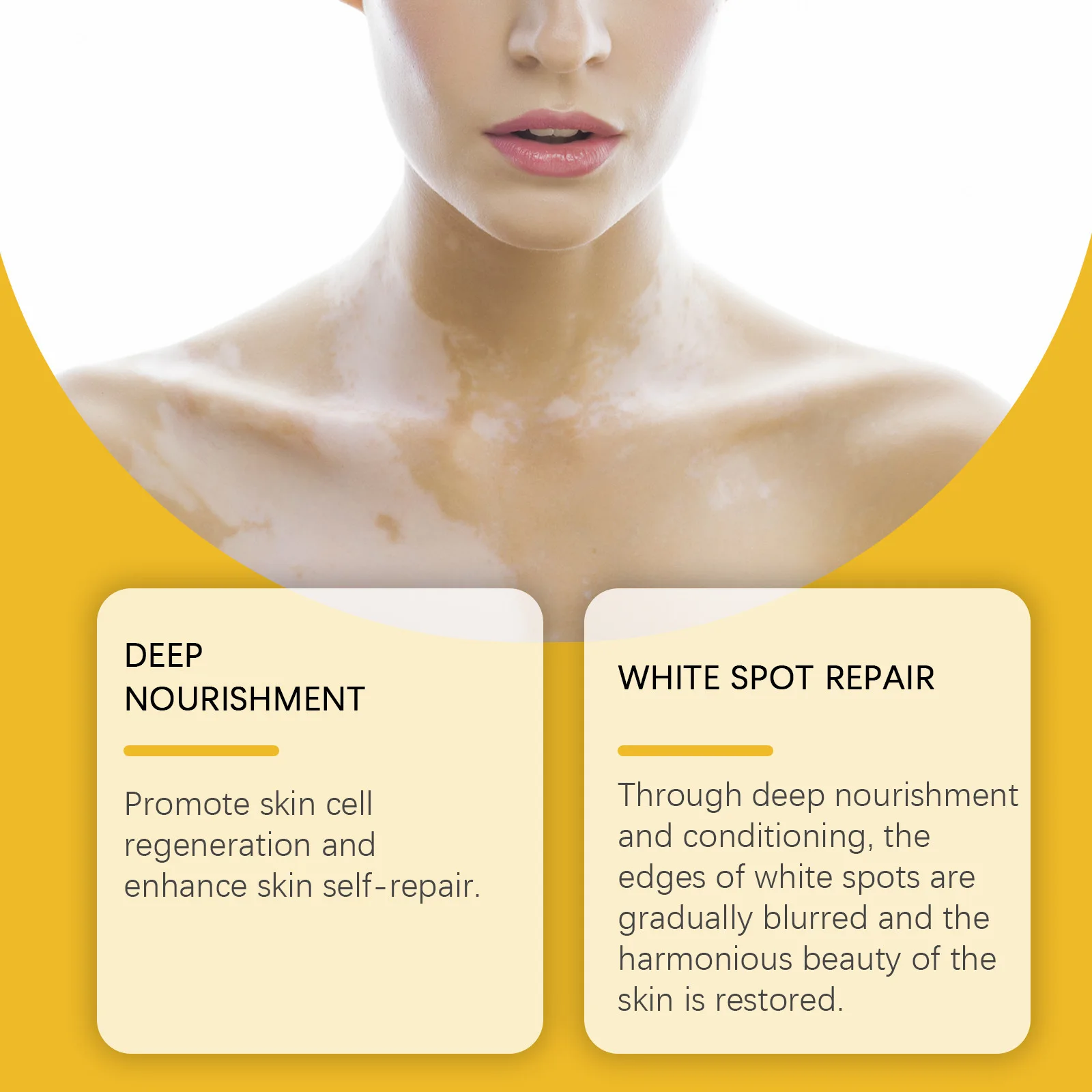 Bee Venom Vitiligo Soothing Cream Reament Repair Leukoplakia Reduce Pigment Melanin Antibacterial Moisturing Skin Care Cream