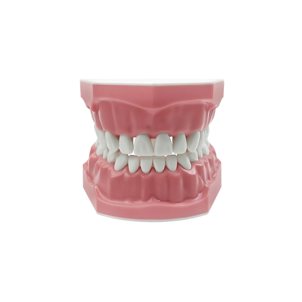 Dental Implant Education Model