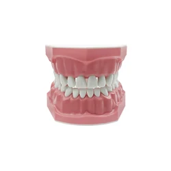 Dental Implant Education Model (Teeth model)
