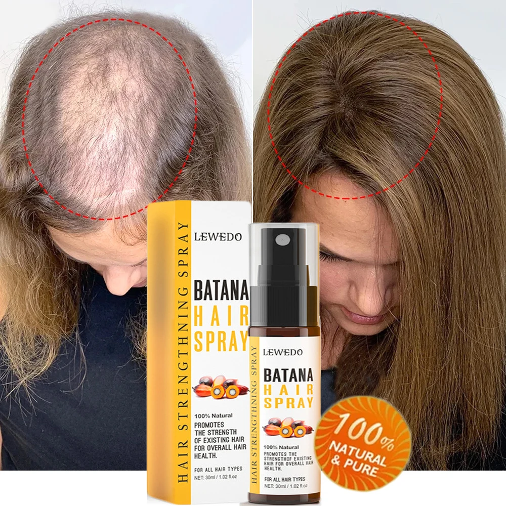 

Fast Hair Growth Spray Natural 100% Pure Batana Oil Anti Break Loss Hair Growth Oil Baldness Treatment Hair Care Products