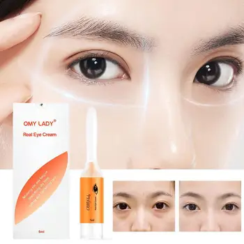 OMY LADY 아이 크림, 주름 방지, 즉시 서클 제거, 다크 언더 케어, 퍼밍 아이백, 5ml