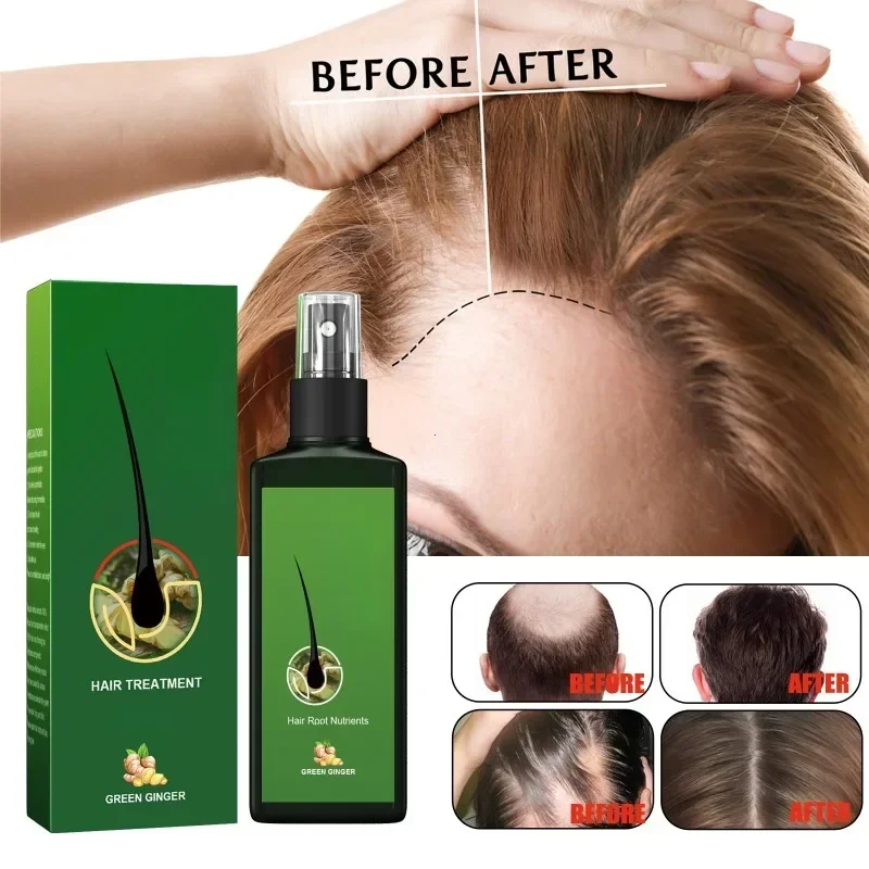 Zenzero naturale Cura dei capelli Olio essenziale Radice Crescere Anti perdita di capelli Siero Liquido Cuoio capelluto Danneggiato Trattamento Riparazione Prodotti per la cura - immagine 2