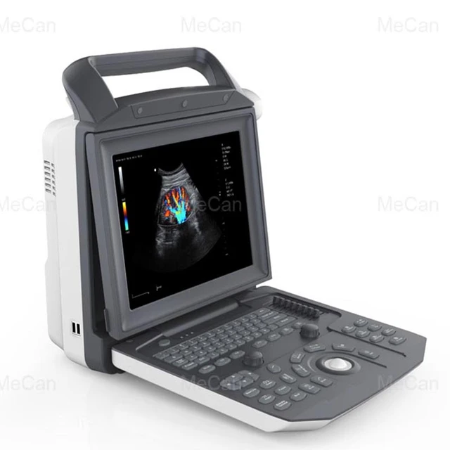 Ecografo médico portátil, máquina de ecocardiografía 3D con Doppler a Color,  escáner de ultrasonido portátil para ser humano - AliExpress