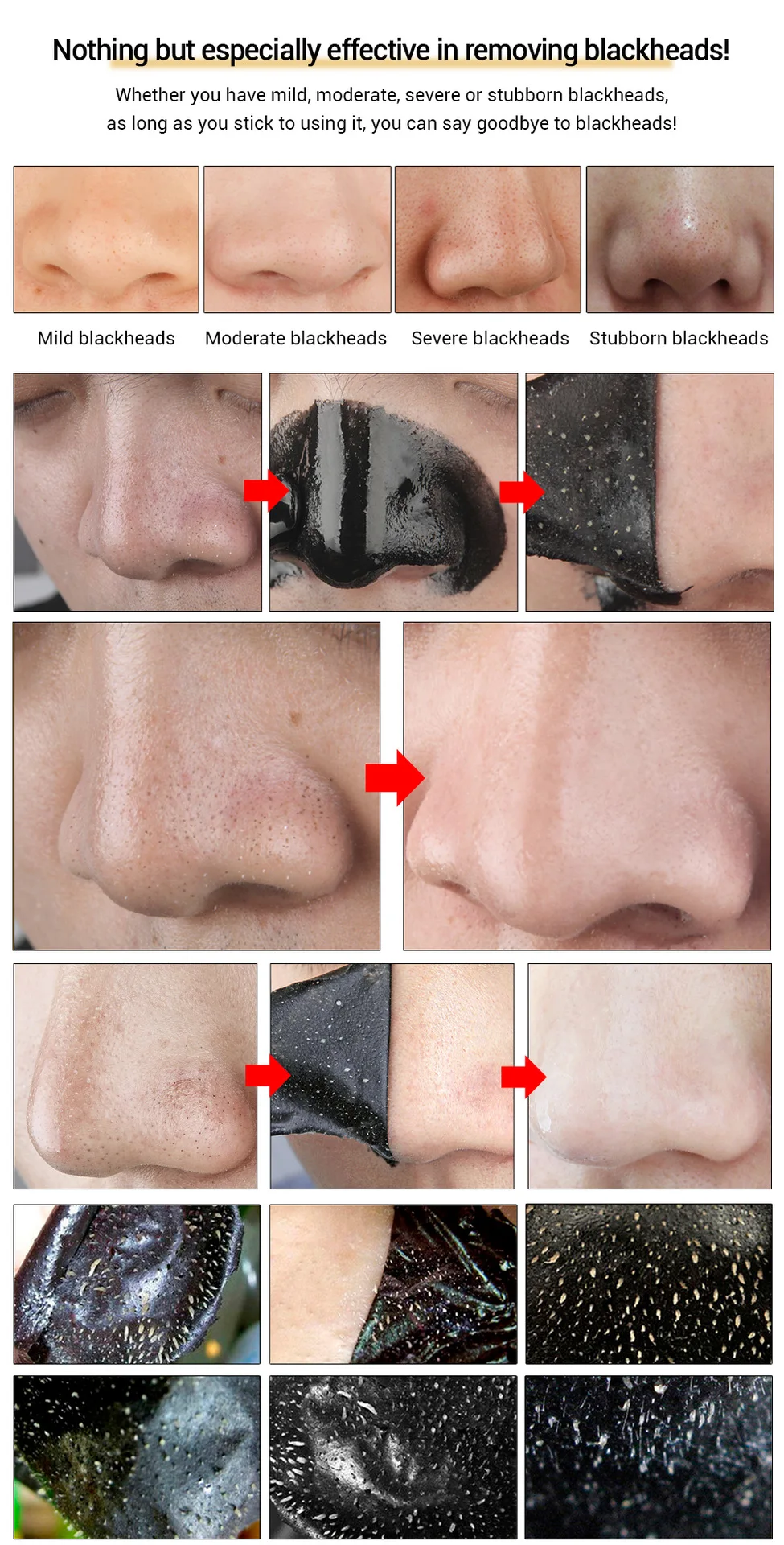 Description Picture 6 of item5PCS Peel Off Black Face Mask Blackhead Remover Acne Treatment Nose Sticker Oil-control Pore Strip Cleanser Face Mask Skin Care