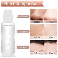 Electric Skin Scrubber Peeling Blackhead Remover Deep Face Cleaning Lifting Ion Acne Pore Cleaner Facial Spatula Shovel Cleanser 4