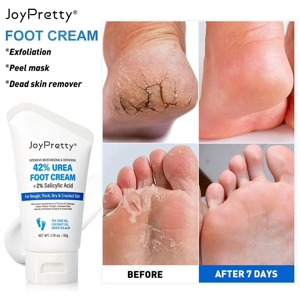 

Fast Exfoliator Foot Cream Dead Skin Remover Heel Crack Repair Cream Treatment Moisturizing Hand Feet Skin Care Foot Mask 2024