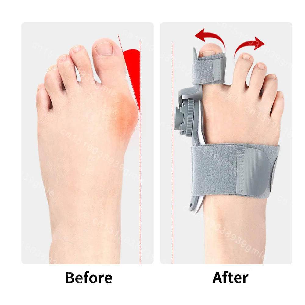 Unisex Bunion Corrector Foot Hallux Valgus Braces Rotatable Toe Separator Straightener Adjustable Pedicure Finger Toe Corrector
