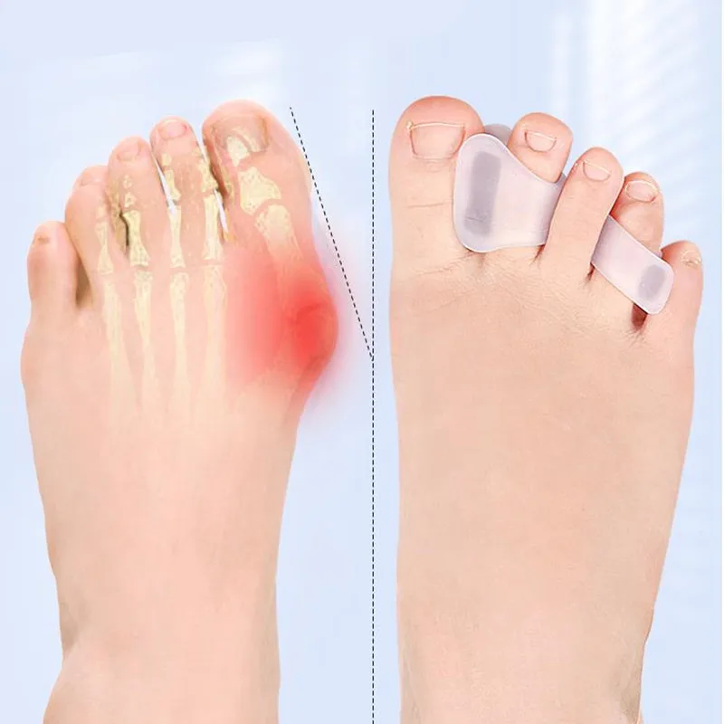 Foot Care Pedicure Silicone Gel Straightener Two Hole Toe Separator Fingers Protector Bunion Adjuster Hallux Valgus 2pcs = 1pair toe separators finger toe separator toe protectors